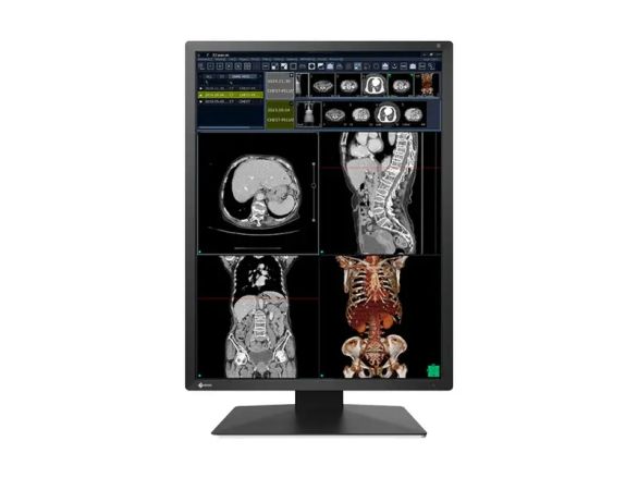 Медицински монитор EIZO Radi Force RX270 - 21.3" инч, 2MP Цветен LED