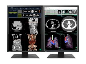 Медицински монитор EIZO Radi Force RX270 - 21.3" инч, 2MP Цветен LED