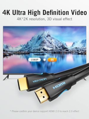 Vention кабел Cable HDMI 2.0 15.0m - 4K/60Hz Black - VAA-M02-B1500